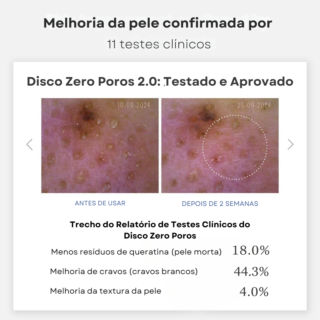 Disco Zero Poro 2.0 | PAGUE 1 LEVE 2
